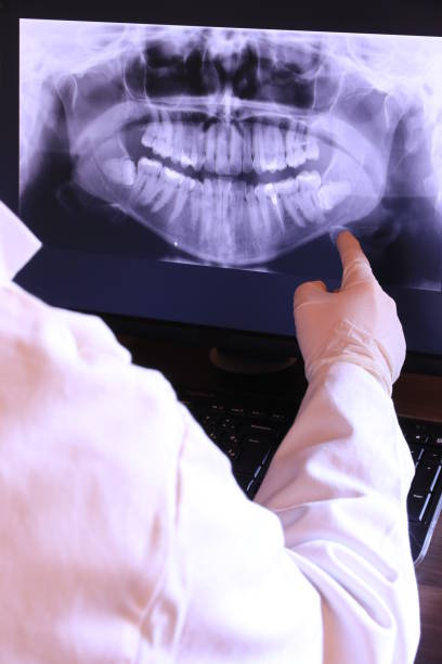 Best Emergency Dental Care for Abscessed Tooth in Havre De Grace, MD