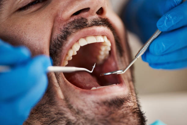 Best Broken or Cracked Tooth Emergency Dentist in Havre De Grace, MD
